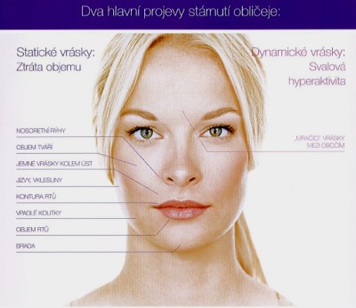 juvederm.jpeg